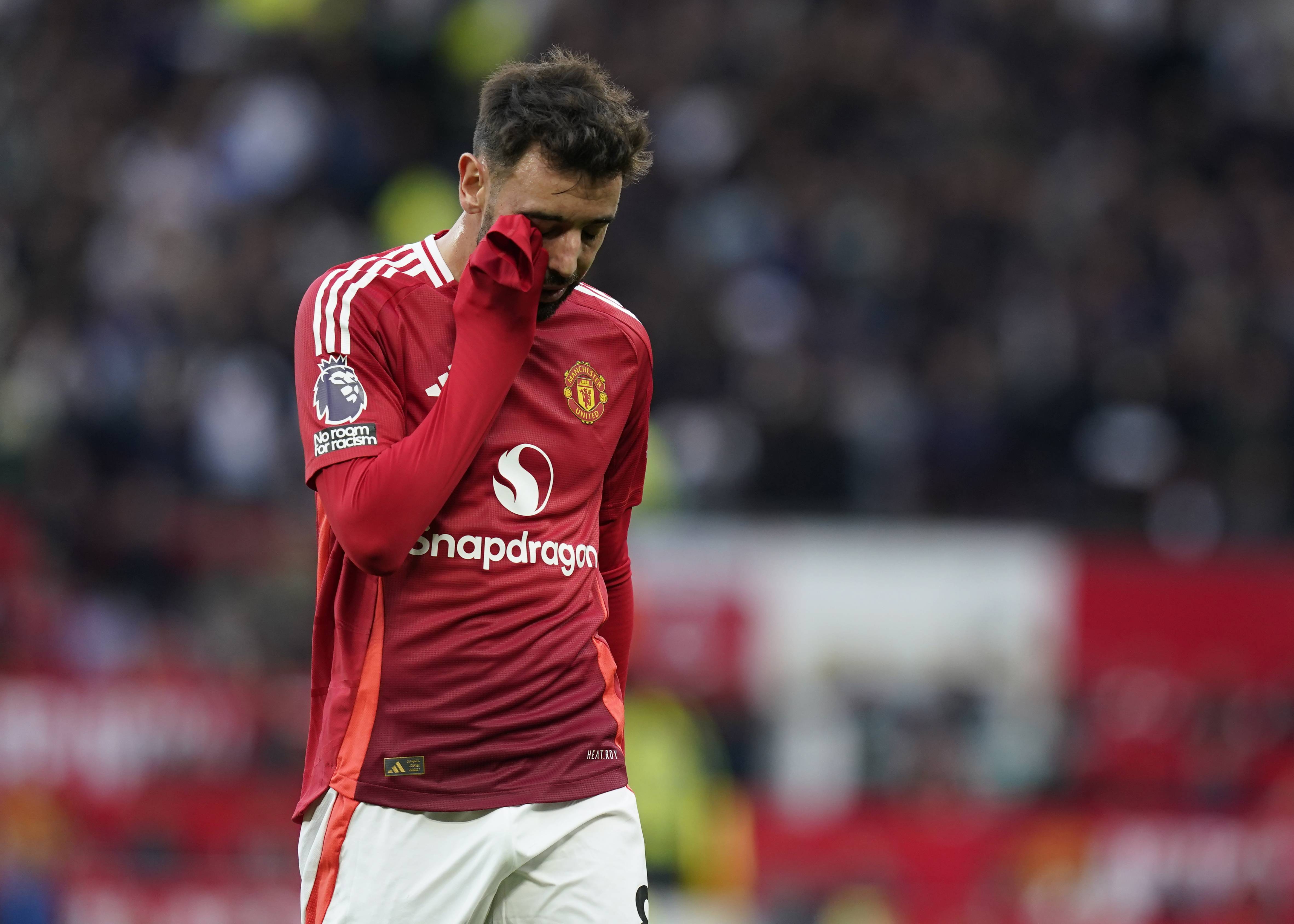 曼联门将因伤错失关键比赛，球迷心疼